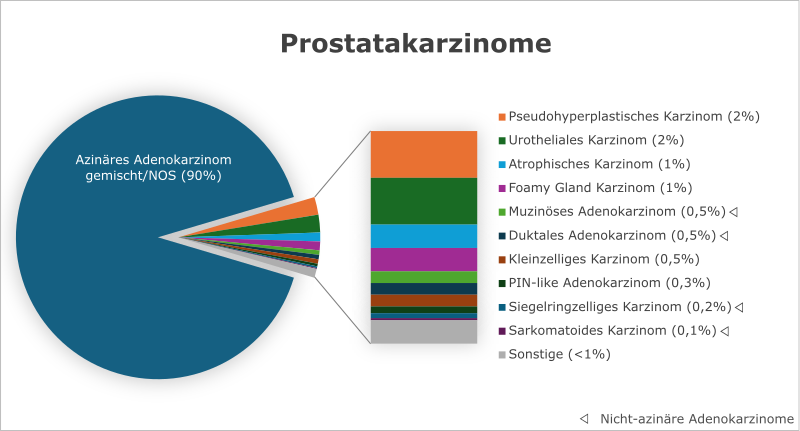 Prostatakarzinom Subtypen